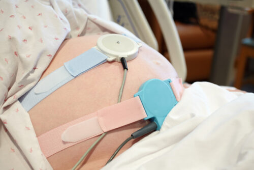 Pregnancy Fetal Monitor Sensors on Woman